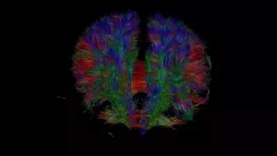 Philips NeuroScience extension MR clinical application - Philips
