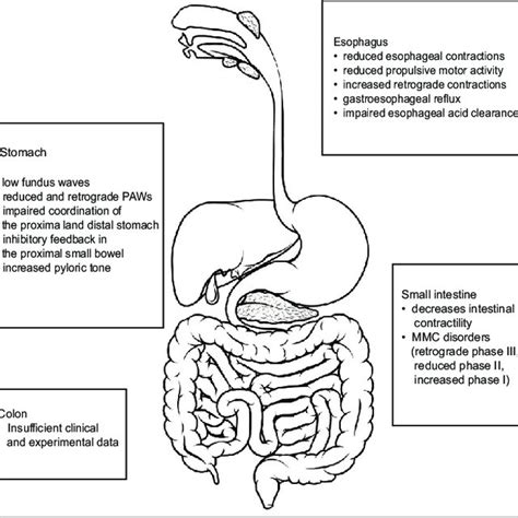Image result for Colon Polyps Types