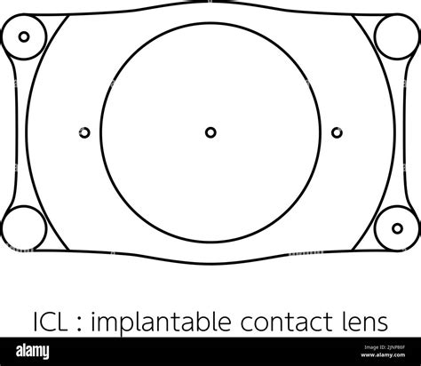 Implantable contact lens hi-res stock photography and images - Alamy