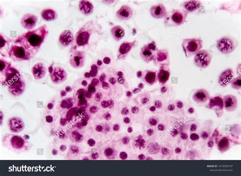 Stages Of Meiosis Microscope