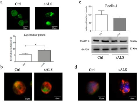 Lysosomes Dysfunction Causes Mitophagy Impairment in PBMCs of Sporadic ...