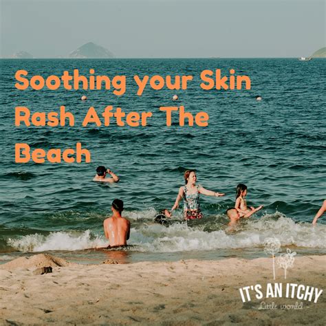 Soothing your Skin Rash After The Beach