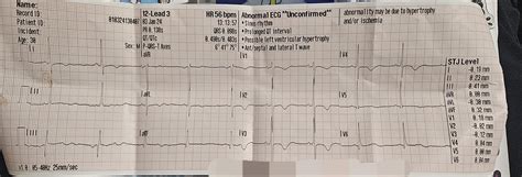 Wellens? : r/EKGs