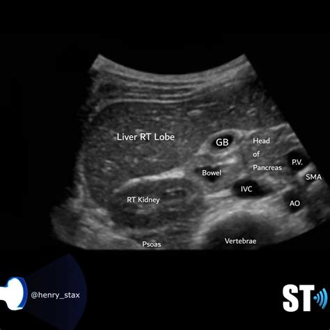 Normal Liver Ultrasound Images