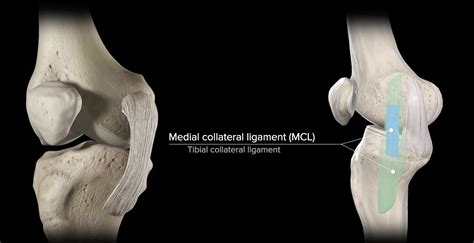 Tibial Collateral Ligament