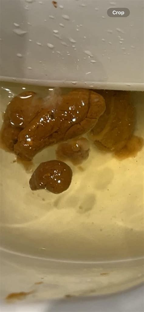 Why Does My Faeces Float