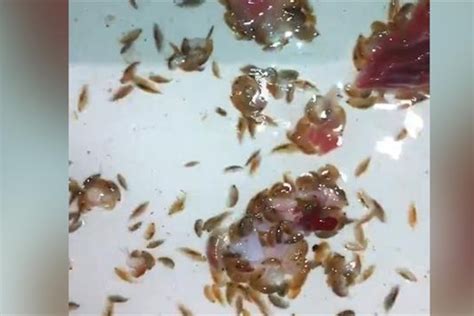 Sea Lice Bites On Humans