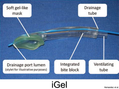 Image result for Make a Generator Parallel Connection