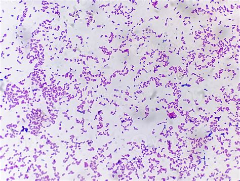 Escherichia Coli Gram Stain