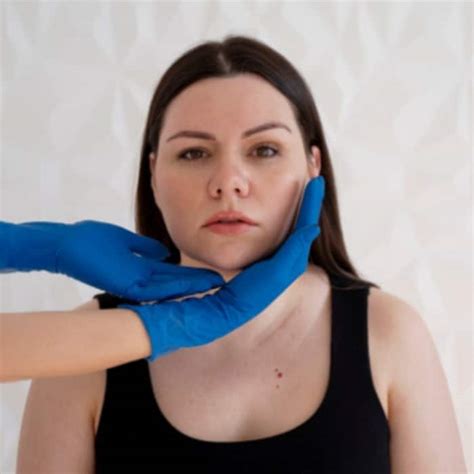 Early symptoms of brain stroke that every adult should know