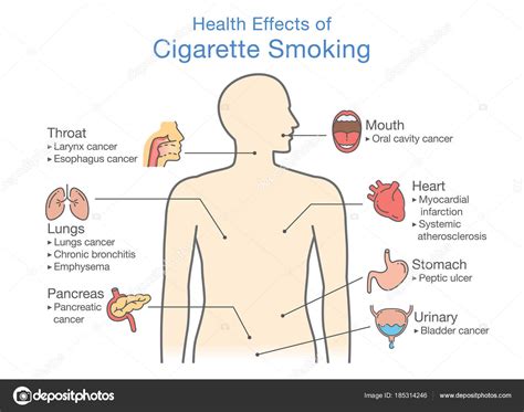 Smokers Lungs Diagram