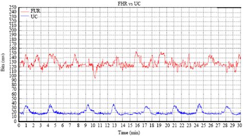 Computerized Algorithm 的图像结果