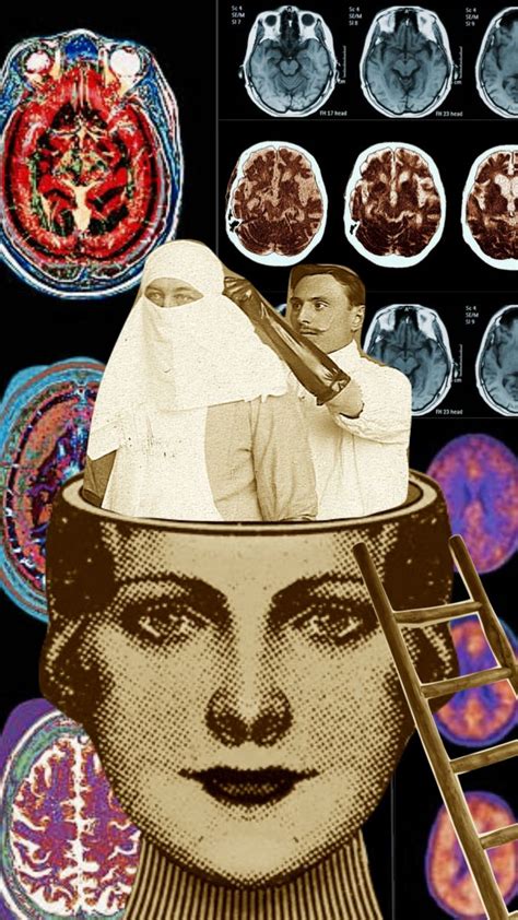 depression brain scan