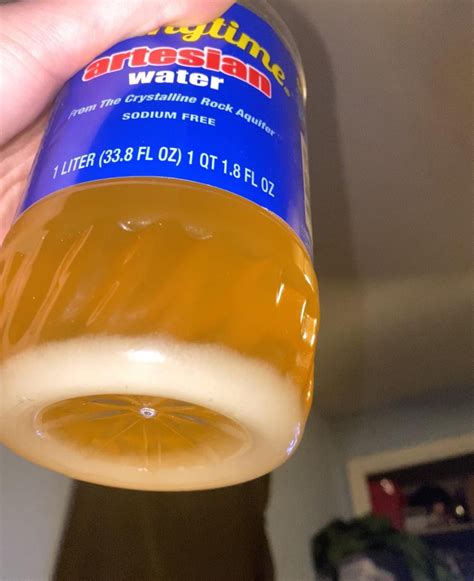 What is this white stuff in my urine? : r/kidney
