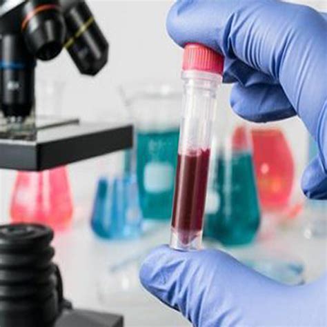 Bio Med Service |IVD Products