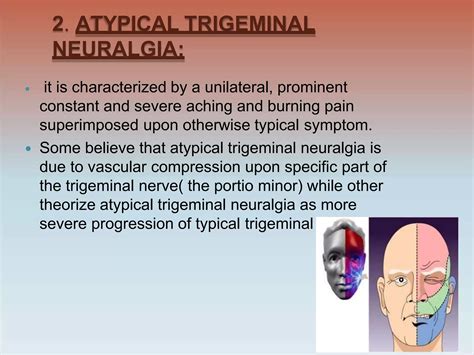 Trigeminal_neuralgia_.pptx
