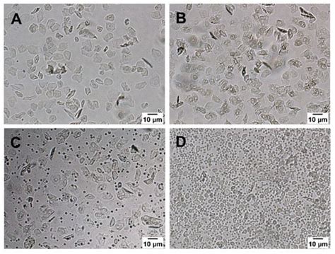 Disruption of Vitamin D Signaling Impairs Adaptation of Cerebrocortical ...