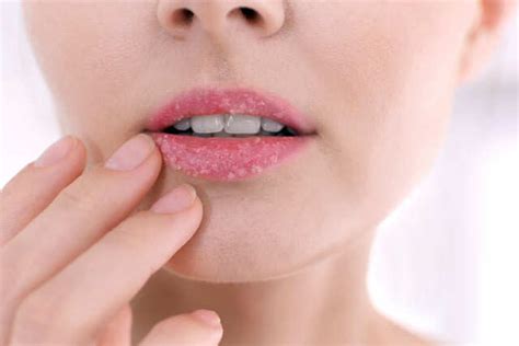 9 Benefits An Use Honey for Face | Femina.in