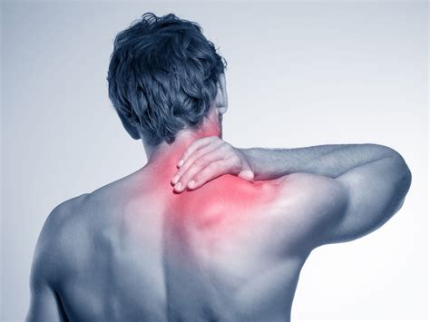 Discovering Upper crossed Syndrome | Have a closer look