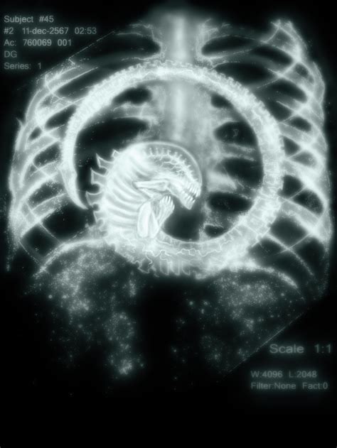 Funny Xray Images