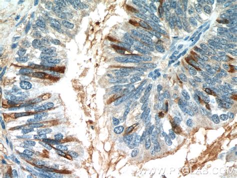 MUC16/CA125 antibody (60261-1-PBS) | Proteintech