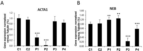 Actin Polymerization Defects Induce Mitochondrial Dysfunction in ...