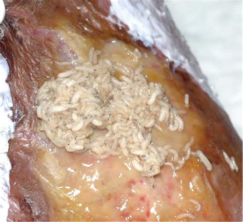 Topic One: Larval Therapy | ActivHeal® Academy