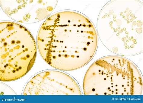 Growing Bacteria in Petri Dishes on Agar Gel Scientific Experiment ...