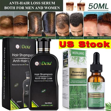 Buy Dexe Original Anti Hair Loss Shampoo, Organic Rosemary Serum Oil ...