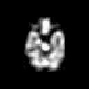 Image result for Deconvolution Examples