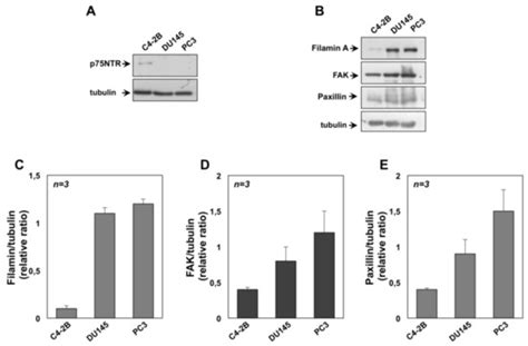 Cancers | Special Issue : Prostate Cancer: Past, Present, and Future
