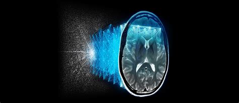 AIR™ Image Quality | GE HealthCare (India)