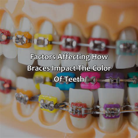 What Color Braces Make Your Teeth Look Whiter - colorscombo.com