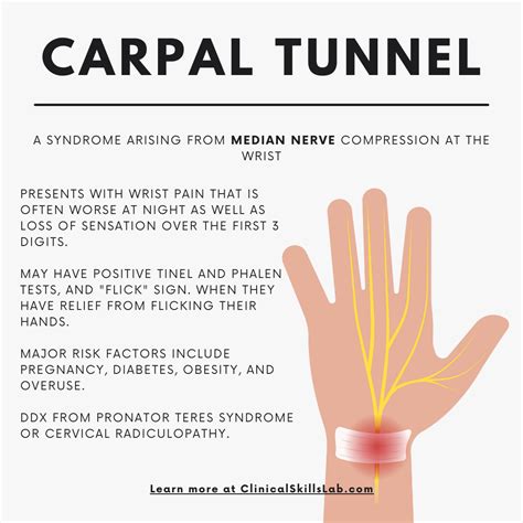 Carpal Syndrome Home Remedies