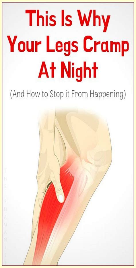 Leg cramps at night causes and remedies – Artofit