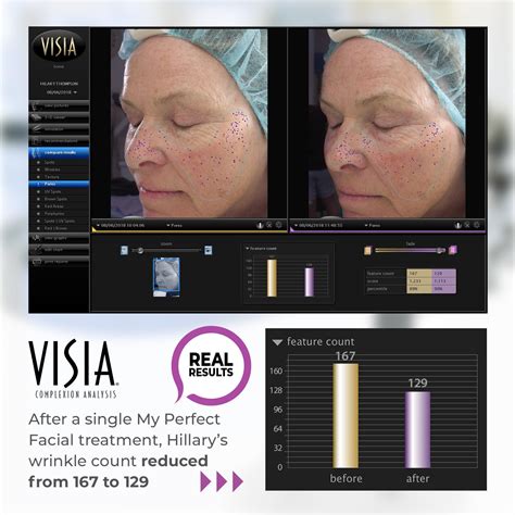 MyPerfect Firming & Tightening Anti-Ageing Face Mask - 10 India | Ubuy