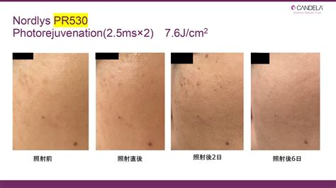 Image result for Bad Graphical Abstract Examples