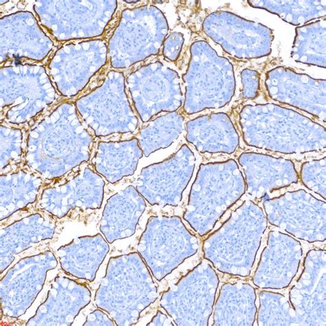 Small Intestine stained with Anti-ACE2