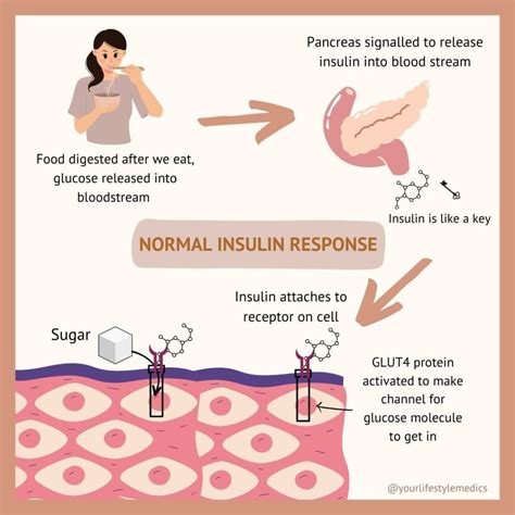 How To Reverse Insulin Resistance Naturally – Your Lifestyle Medics