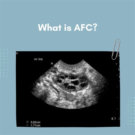 What is AFC: A simple guide for IVF patients | Embryopedia