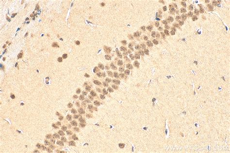 EGR2 antibody (13491-1-AP) | Proteintech