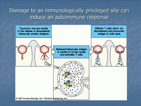 Autoimmunity Lecture 的图像结果