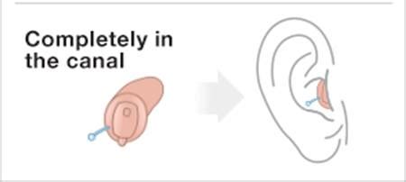 Styles of Hearing Aids: Behind the ear, Receiver in the canal or ear ...