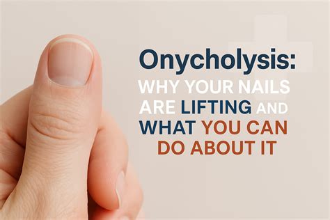 Onycholysis: Why Nails Lift & Treatment Options | 2025