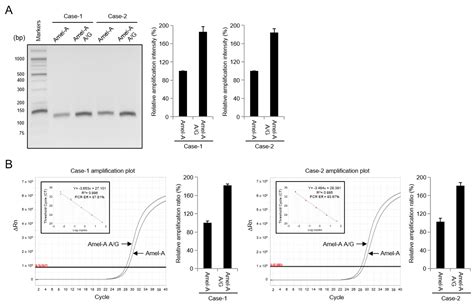 Amplification Failure of the Amelogenin X Gene Caused by a Rare ...