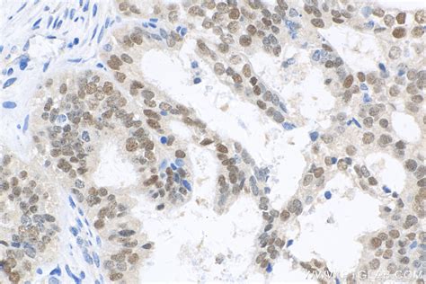 PAX8 antibody (80756-1-RR) | Proteintech
