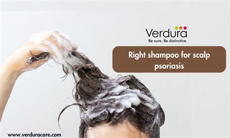 Right shampoo for scalp psoriasis – Verduracare.com