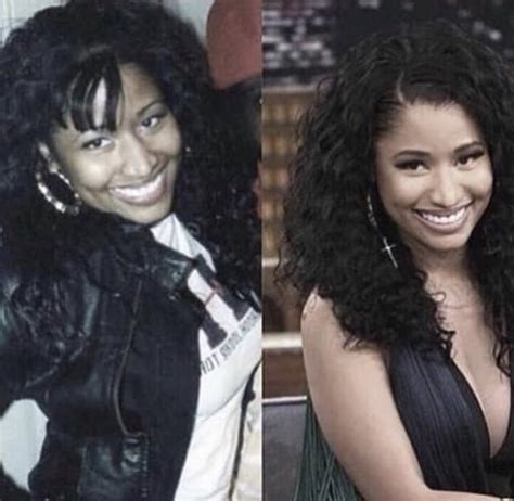 Nicki Minaj Plastic Surgery Before And After Pictures 2018 Nicki Minaj