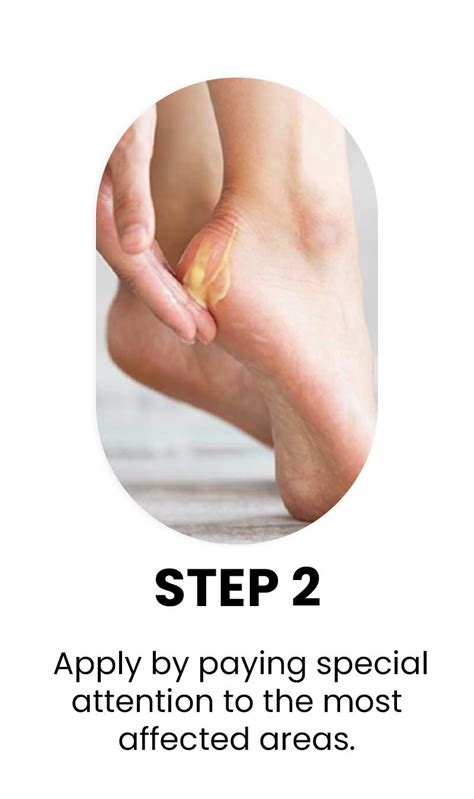 Varco DiaFoot Crème- 50gm – Varco Leg Care