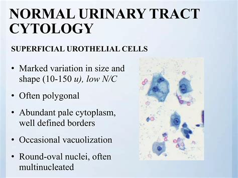 cytology of urinary tract | PPTX